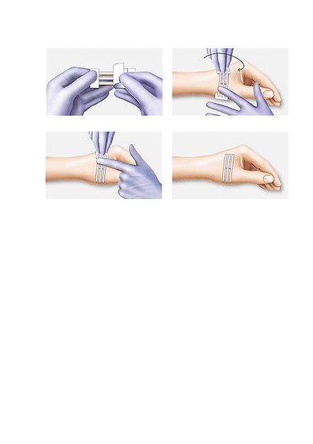 Hartmann Omnistrip® wondhechtstrip