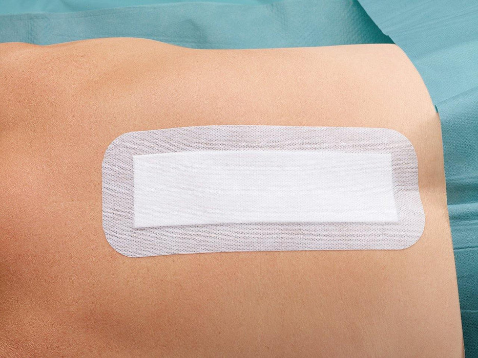 Cosmopor Steriel eilandpleister 10×20 cm met wondkussen
